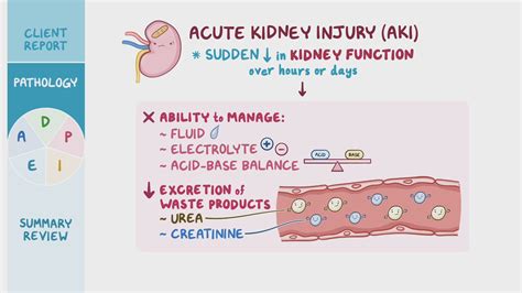 sex aki|Sex as a biological variable in acute kidney injury